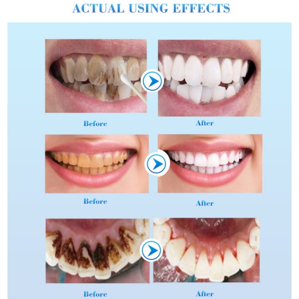Efero Teeth Whitening Essence Liquid