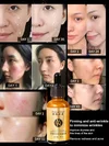 🏆【BUY 1 FREE 1】The secret of beautiful Korean women lies in this Anti-Wrinkle Lifting and Firming Serum! Essence Full Face Light Lines! 7 days firming & plumping!