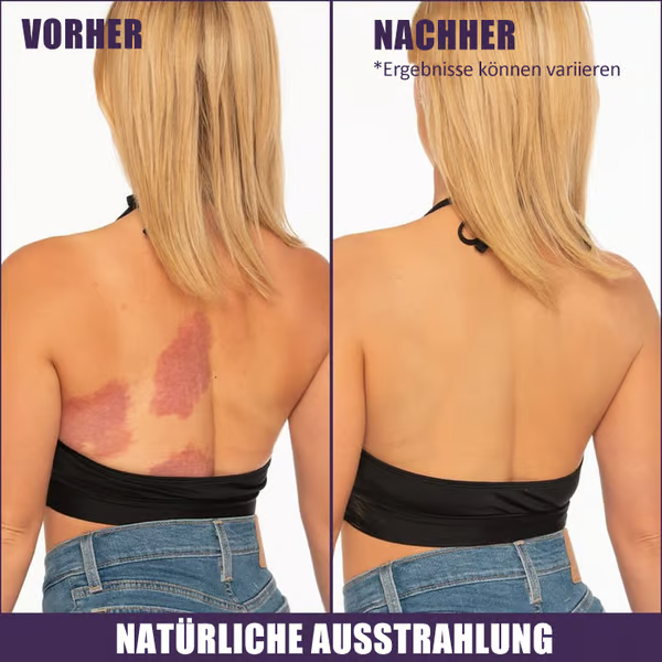 🌟Body Coverage Perfector – Feuchtigkeitscreme, Concealer und Abdeckung in einem 💧✨ Leicht und wasserfest