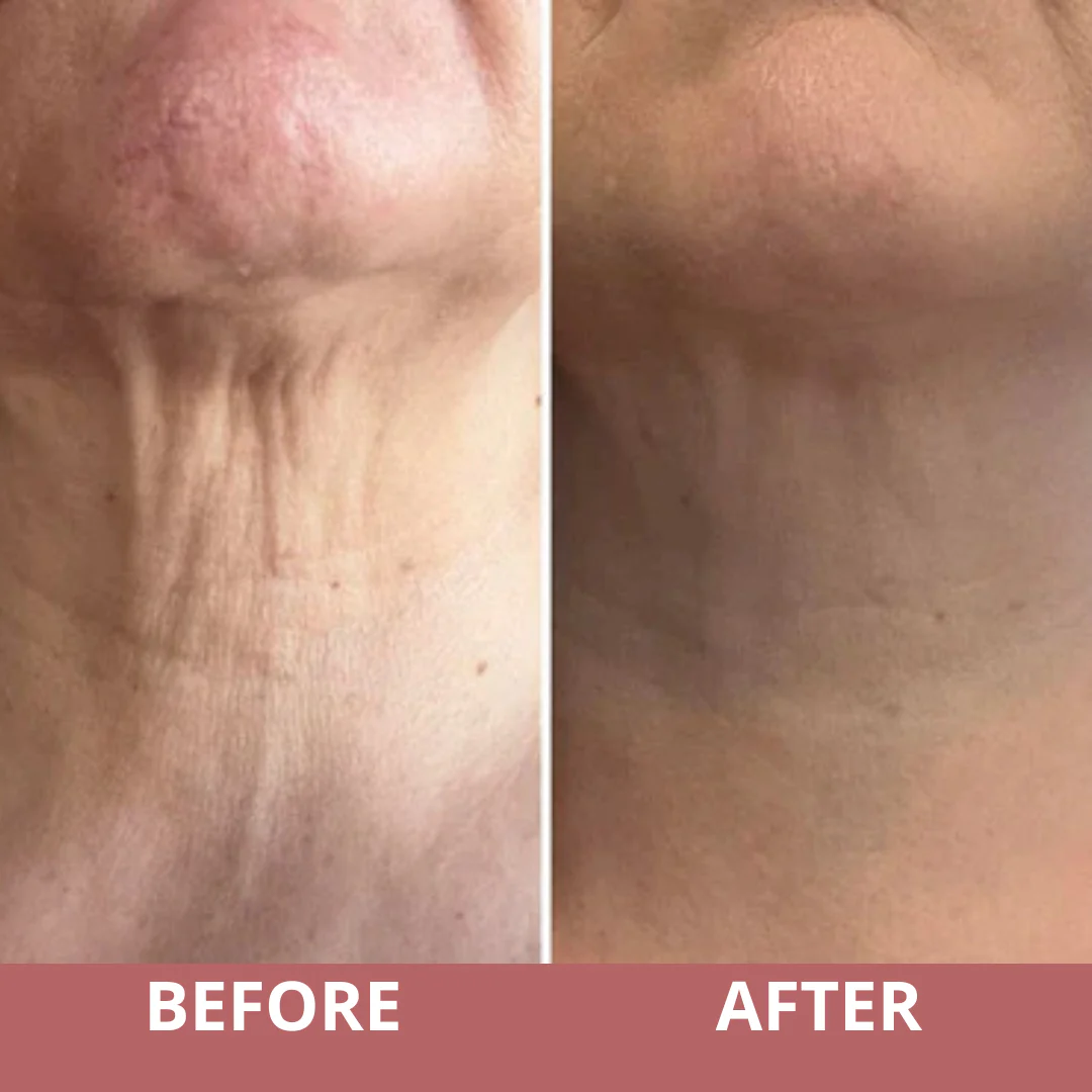 🏆 2025 Rated Skin Care Innovation:TIGHTEN & LIFT NECK CREAM by CocoBeauty