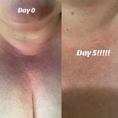 Tighten Neck & Arm Cream