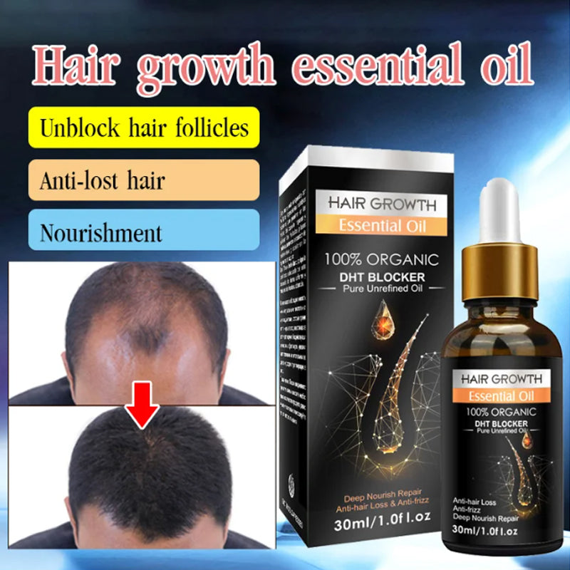 Hair growth essential oil