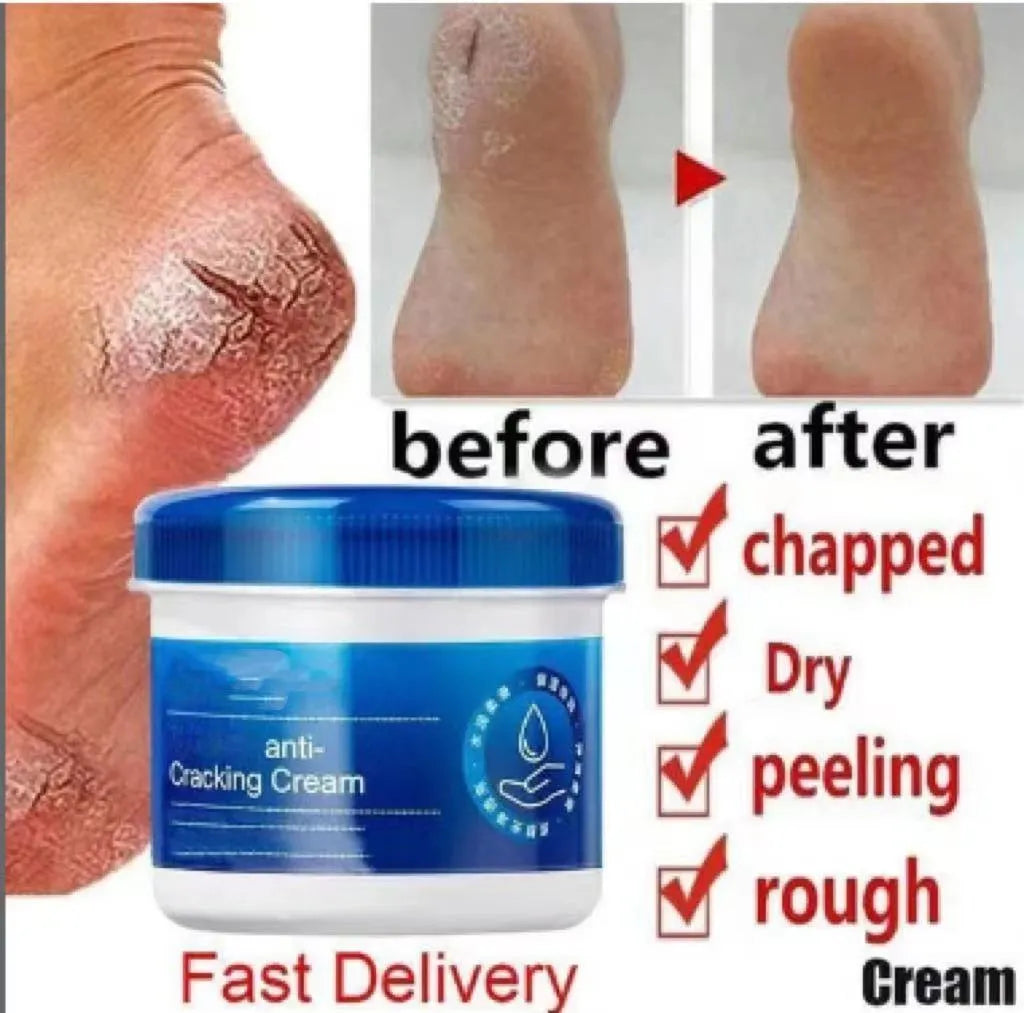 Foot Cream Anti-cracking Moisturizing Foot and Hand Cream Beauty đ„BUY 2 GET 1 FREE