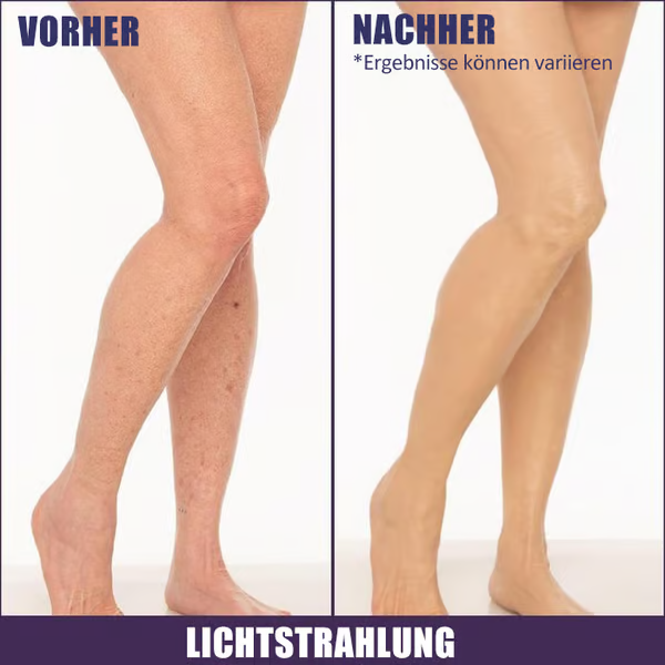 🌟Body Coverage Perfector – Feuchtigkeitscreme, Concealer und Abdeckung in einem 💧✨ Leicht und wasserfest