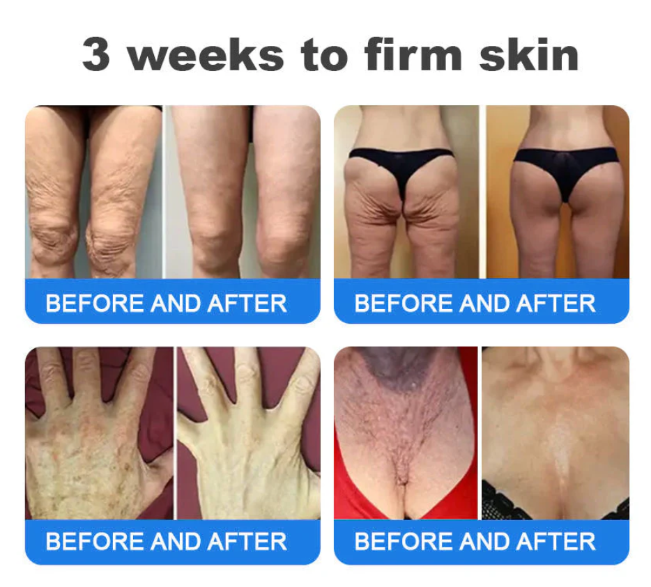 Emu Oil Firming & Anti-Wrinkle Cream 🔥 Last Day 50% Off 👩MHRA Certified – Clinically Proven Firming & Lifting & Soothing Repair 🌿