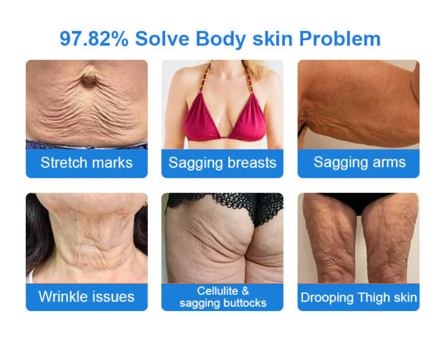 Emu Oil Firming & Anti-Wrinkle Cream 🔥 Last Day 50% Off 👩MHRA Certified – Clinically Proven Firming & Lifting & Soothing Repair 🌿