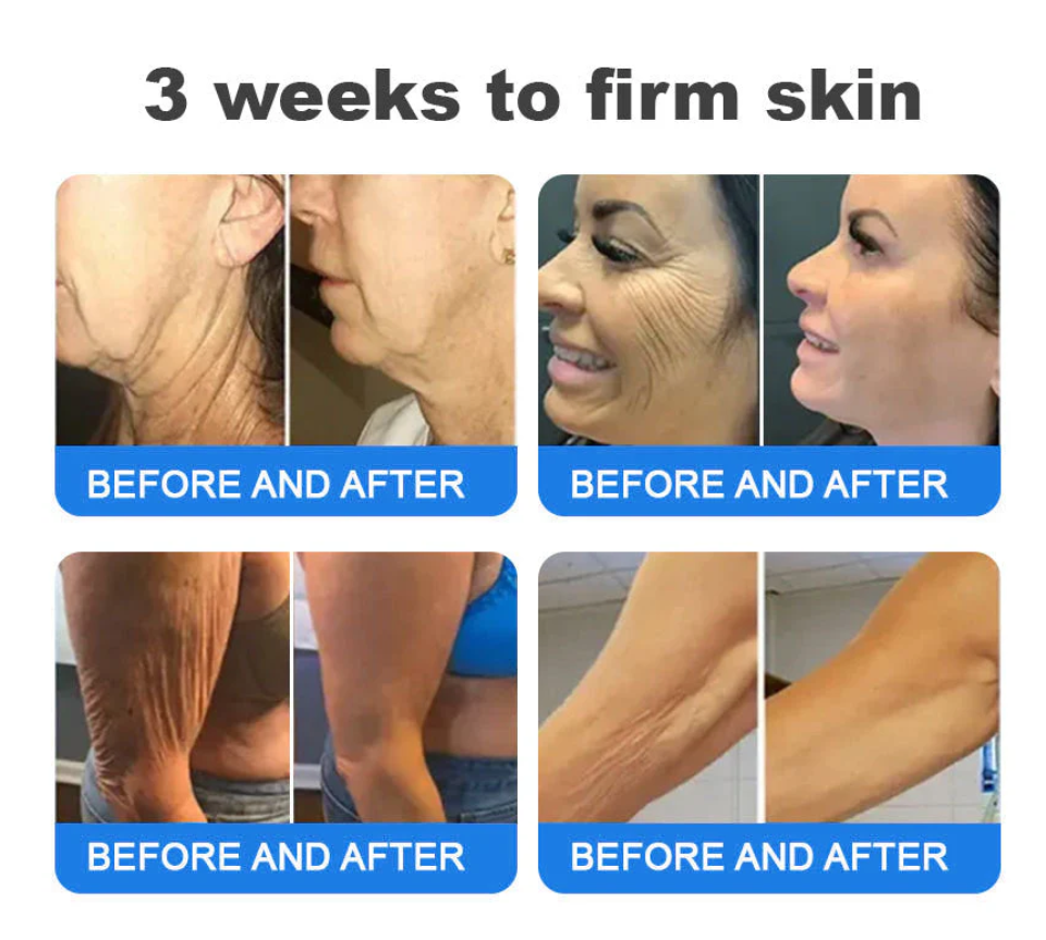 Emu Oil Firming & Anti-Wrinkle Cream 🔥 Last Day 50% Off 👩MHRA Certified – Clinically Proven Firming & Lifting & Soothing Repair 🌿