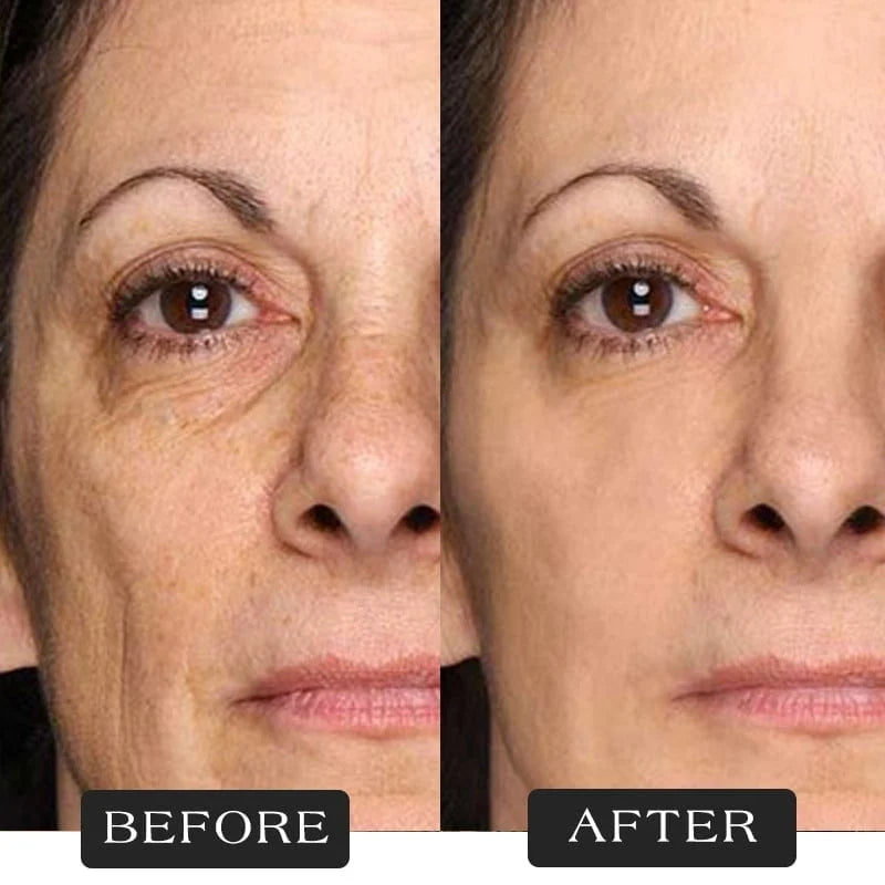 đ„Great Dealsđ - Protein Thread Lifting Set