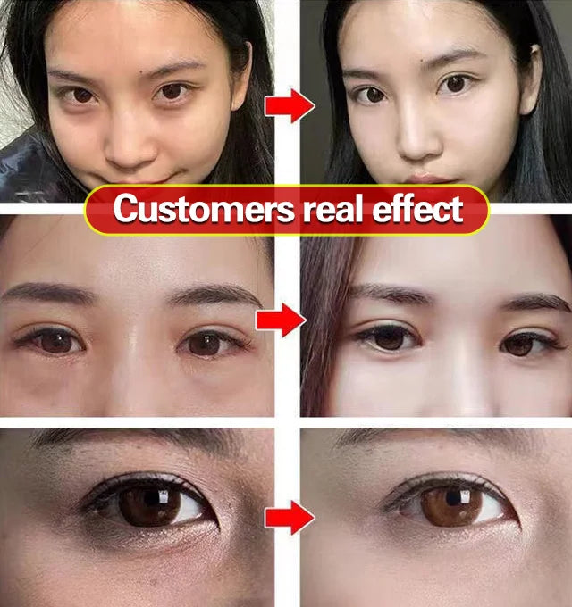 120 Seconds First Aid Vitality Eye Cream