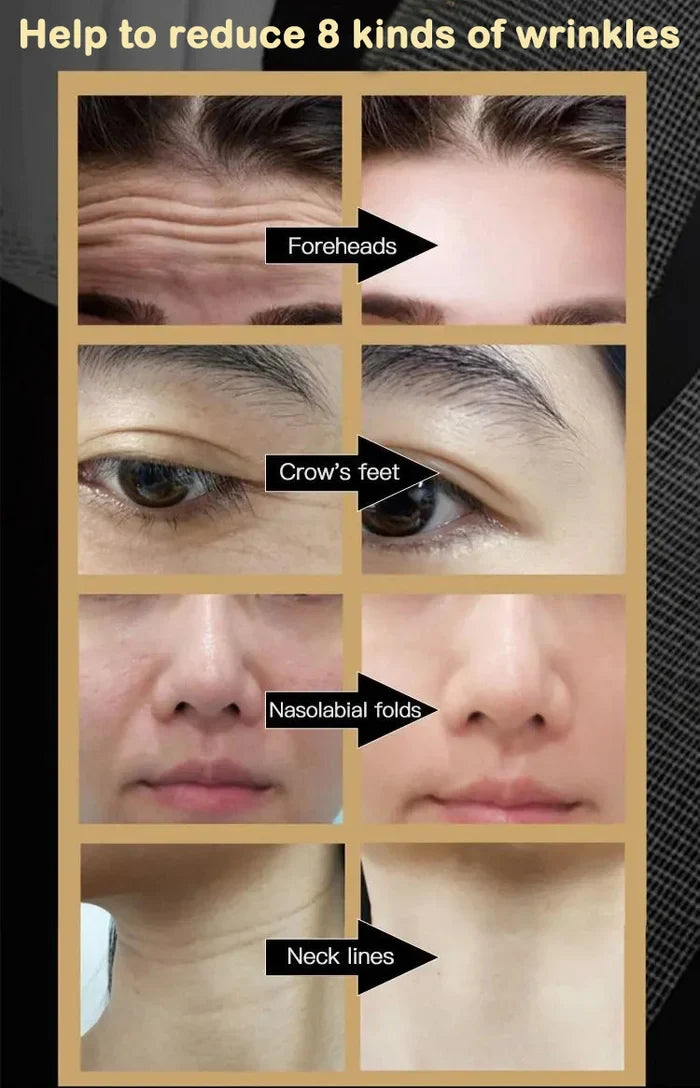 đ„LAST DAY 48% OFFđ„ANTI WRINKLE FACE CREAM