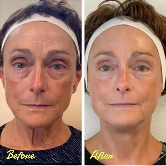 đ„Last Day 49% OFFđInstant Eye Temporary Eye Tightener