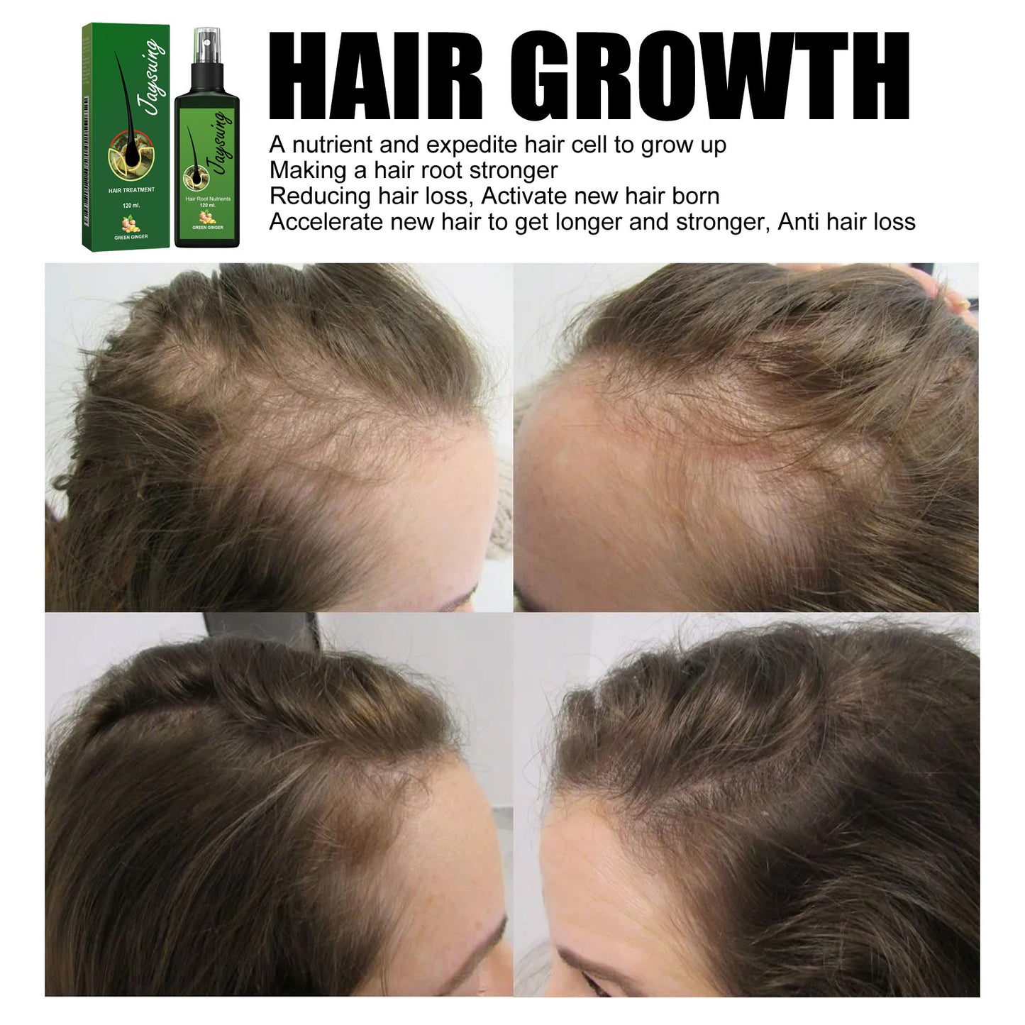 😍Hair Growth Spray, Promotes Thicker And Stronger Hair Care, 100% Natural Ingredients💧🌿