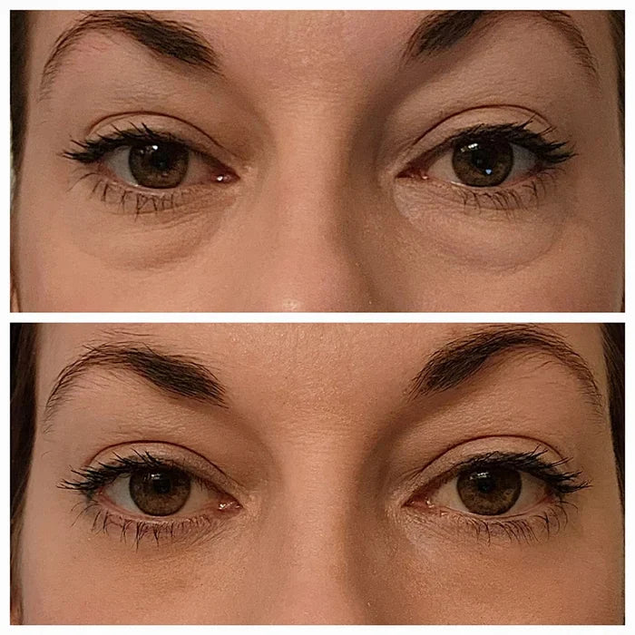 đ„Last Day 49% OFFđInstant Eye Temporary Eye Tightener