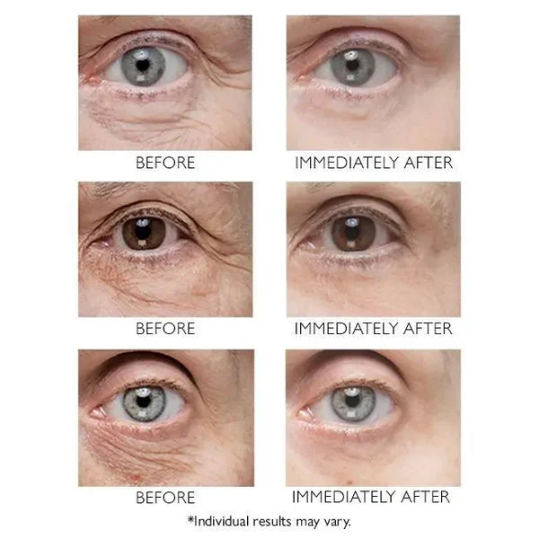 đ„Last Day 49% OFFđInstant Eye Temporary Eye Tightener