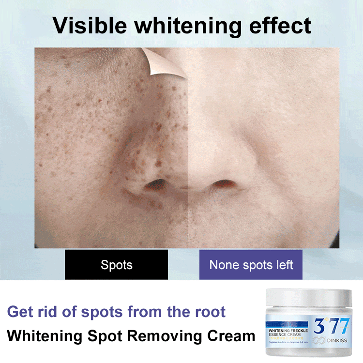 Most Powerful Centennial Whitening Cream-BUY 2 GET 1 FREE( 3 pcs)🔥🔥