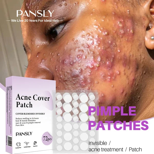 ✨ 2024 Hydrocolloid Acne Cover Patches(🔥Buy 3 Get 3 Free)