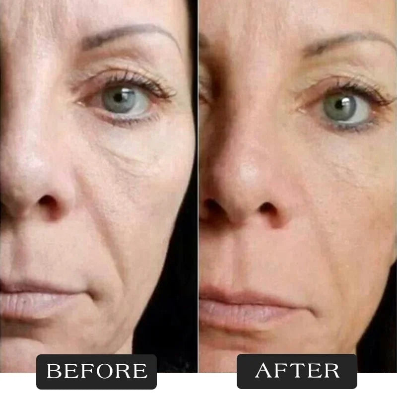 đ„Great Dealsđ - Protein Thread Lifting Set