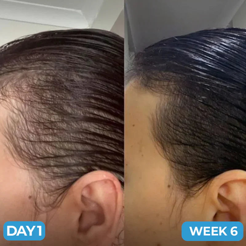 Scalp Hair Growth Serum