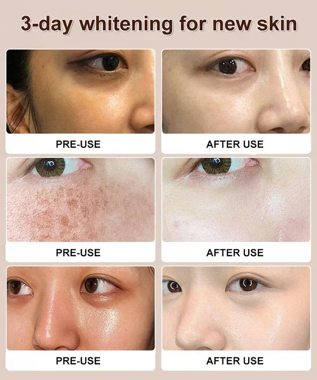 2024 NEW NIACINAMIDE PURIFYING WHITENING CLEANSER 🔥(BUY 3 GET 3 FREE)🔥