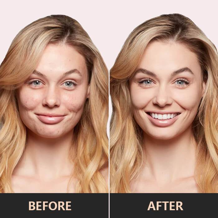 3-In-1 Contouring And Brighten Concealer Paletteđ„BUY 2 GET 1 FREE (3PCS) TODAY ONLY đ„