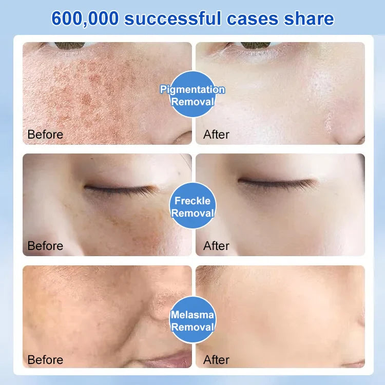 Most Powerful Centennial Whitening Cream-BUY 2 GET 1 FREE( 3 pcs)🔥🔥