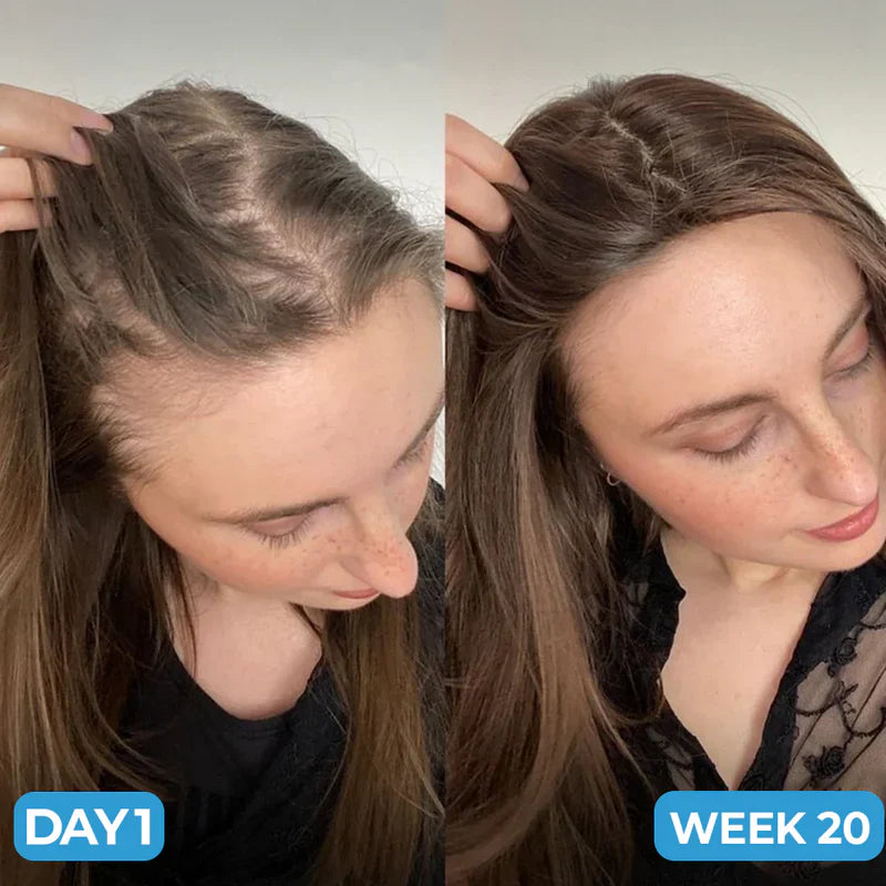 Scalp Hair Growth Serum