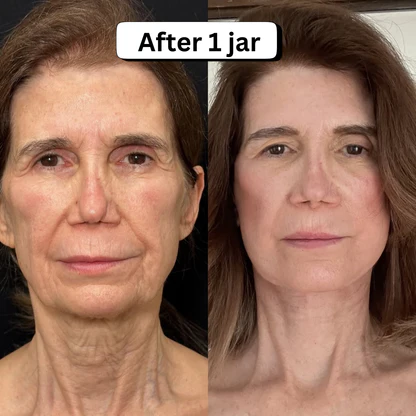 Tighten Neck & Arm Cream