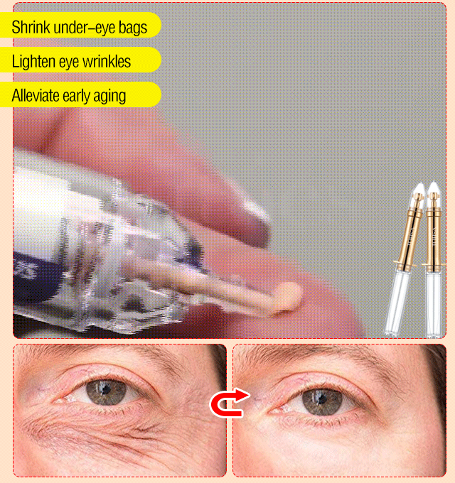 120 Seconds First Aid Vitality Eye Cream