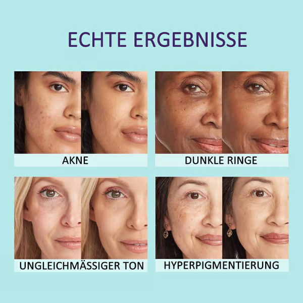 🌟Body Coverage Perfector – Feuchtigkeitscreme, Concealer und Abdeckung in einem 💧✨ Leicht und wasserfest