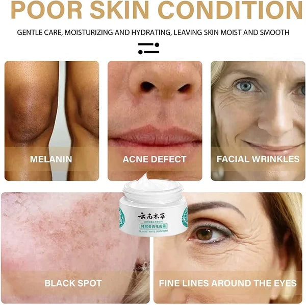 đżJP.HANCY Yunnan Herbal Whitening and Freckle-Removing Cream: Fades Spots and Brightens Skin Tone đ