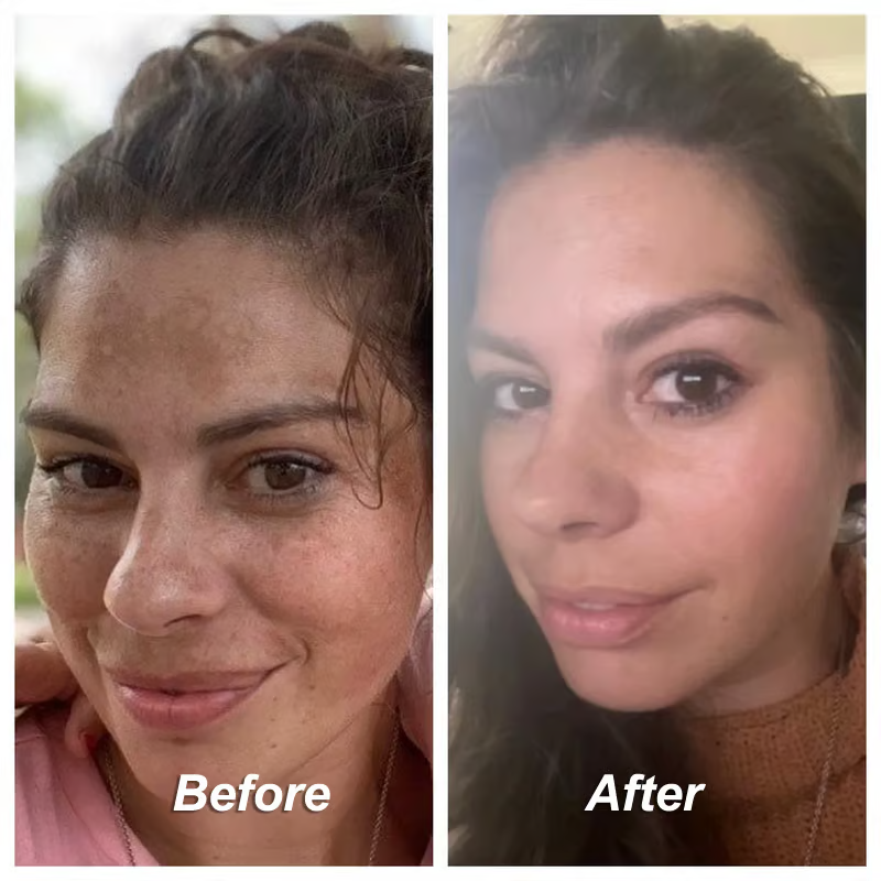 đĽLast Day Promotion 50%OFF- âŁď¸ Venature⢠Bakuchiol Retinol Rejuvenation Serum