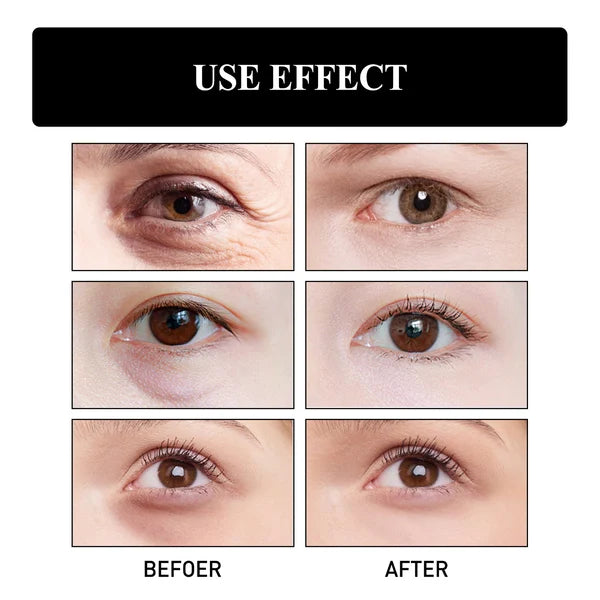Collagen Boost Anti-Aging Serumđ„Refund immediately if there is no effect after use!