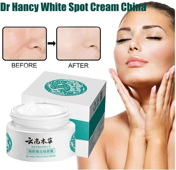 đżJP.HANCY Yunnan Herbal Whitening and Freckle-Removing Cream: Fades Spots and Brightens Skin Tone đ