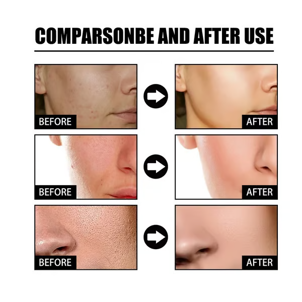 🔥Last Day 90% OFF-Niacinamide Facial Essence💖