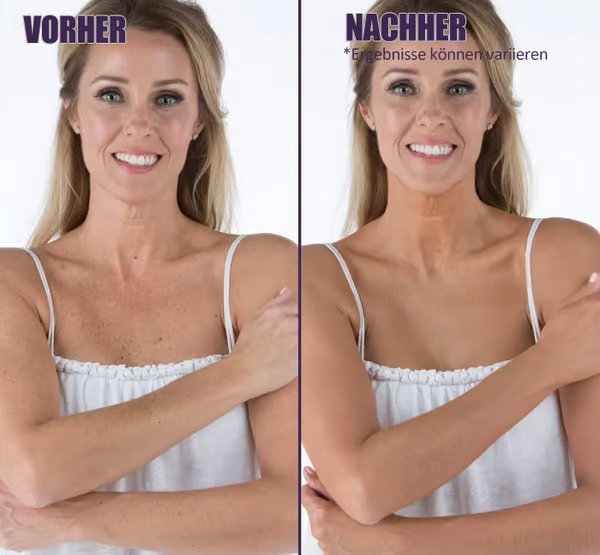 🌟Body Coverage Perfector – Feuchtigkeitscreme, Concealer und Abdeckung in einem 💧✨ Leicht und wasserfest