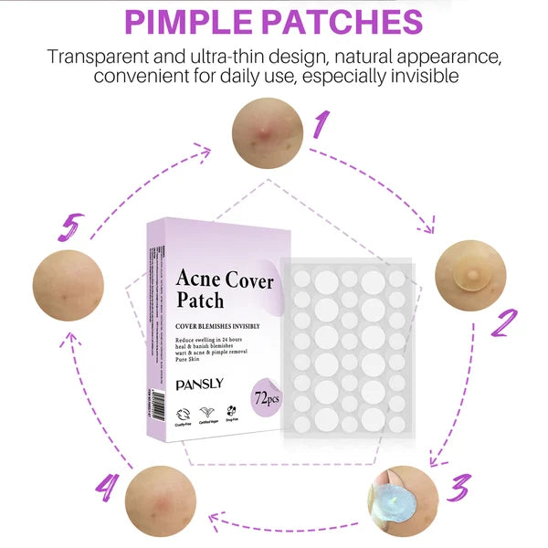 ✨ 2024 Hydrocolloid Acne Cover Patches(🔥Buy 3 Get 3 Free)