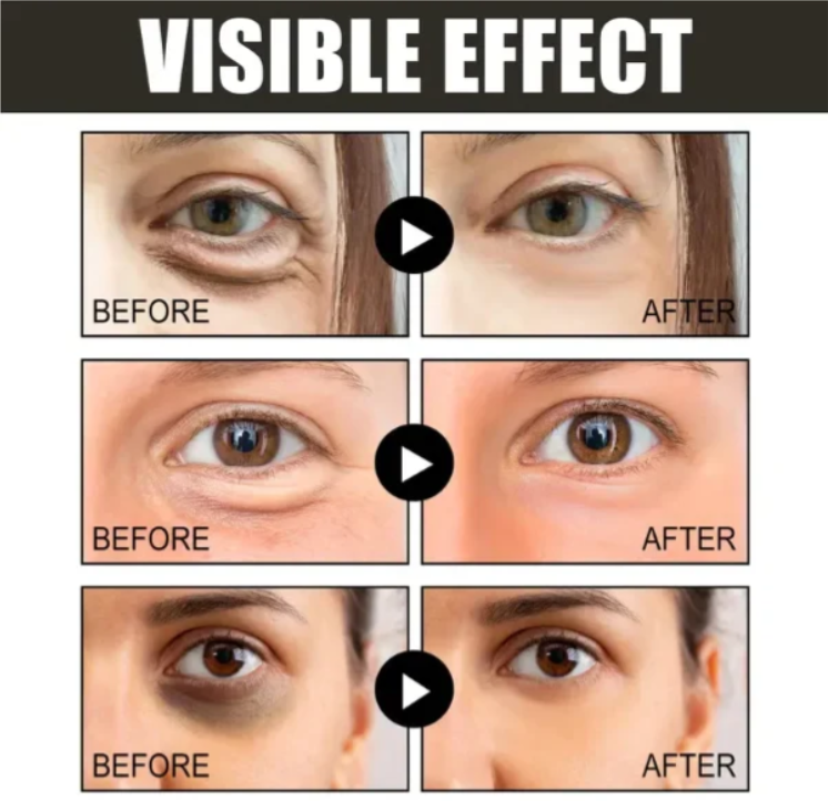 New Retinol Caffeine Anti-Wrinkle Stay-Up Late Eye CREAM