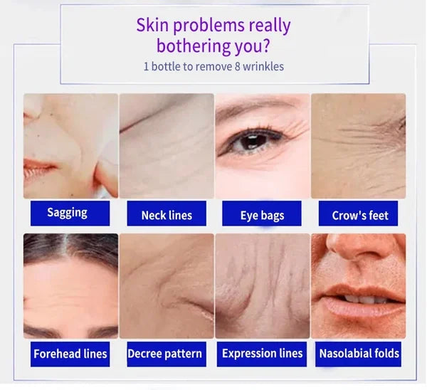 🎉Last Day Promotion - 49% OFF🎉Japanese Anti-wrinkle Rejuvenation Cream