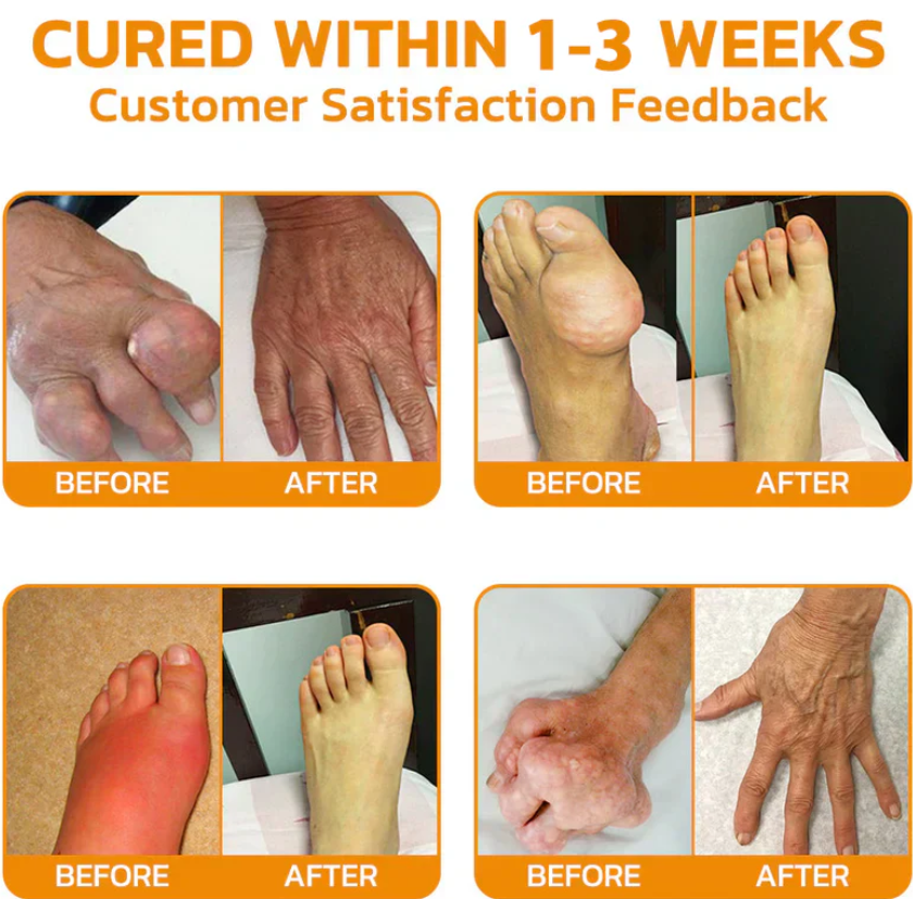 MELIFLEX™ Bee Venom Joint Cream: Gentle for Sensitive Skin, Safe Pain & Inflammation Relief
