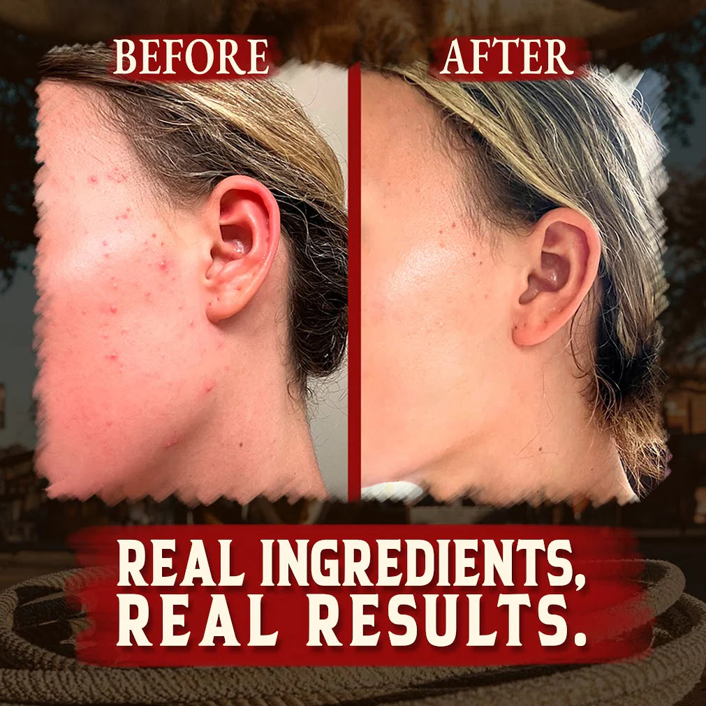 Whipped Tallow & Honey Balm