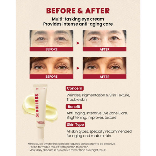 🏆SEOUL 1988 Eye Cream : Retinal Liposome 4% + Fermented Bean