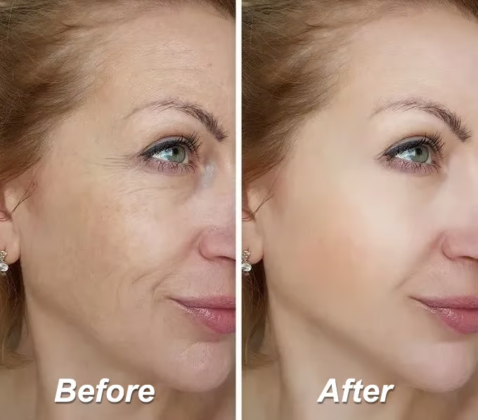 đĽLast Day Promotion 50%OFF- âŁď¸ Venature⢠Bakuchiol Retinol Rejuvenation Serum