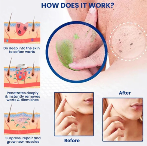 NatureErase Instant Mole and Spot Cream Facial Repair Cream Moisturizing Care