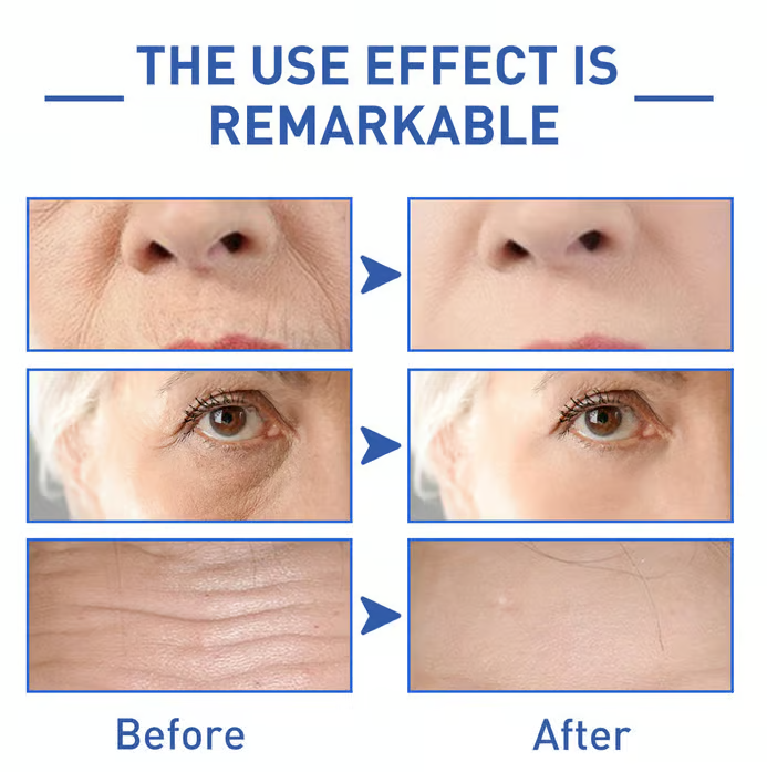 🔥Last Day 90% OFF-Niacinamide Facial Essence💖