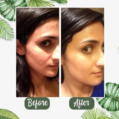 đ” Deep Cleanse Green Tea Mask