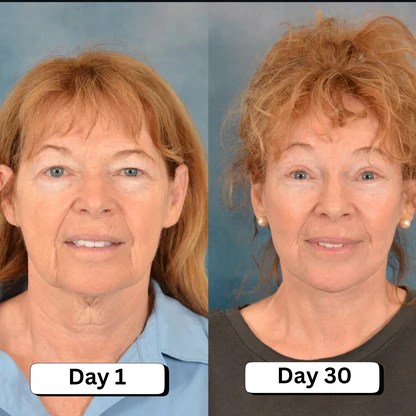 Tighten Neck & Arm Cream