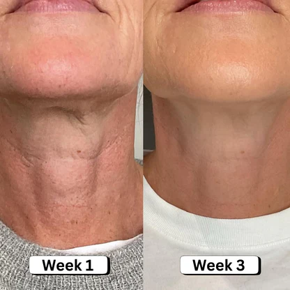 Tighten Neck & Arm Cream