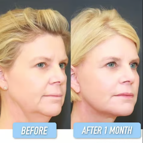 🔥Last Day 90% OFF-Niacinamide Facial Essence💖