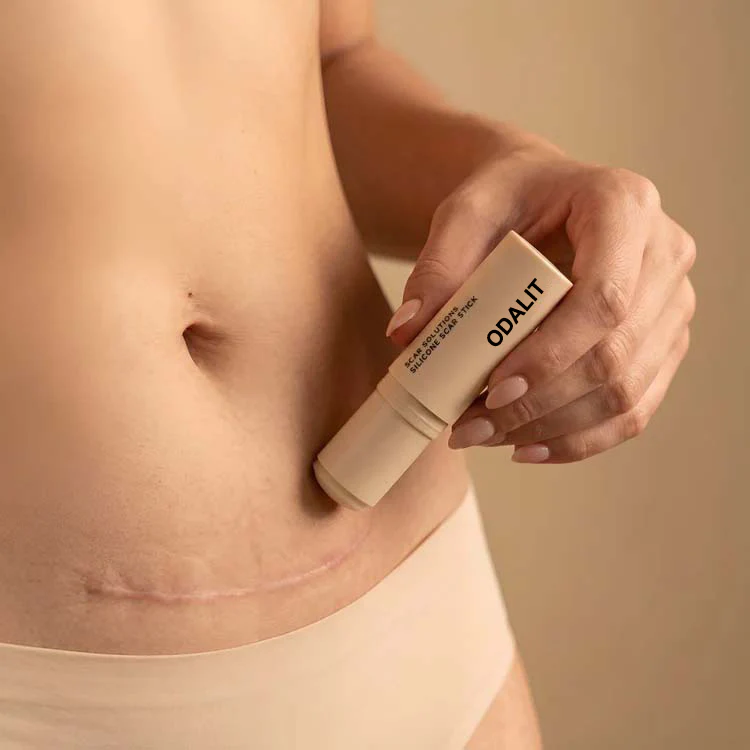 ODALIT™ Silicon ScarStick Limited Time 75%OFF Buy 2 Get 1 Free🔥LAST DAY⏰