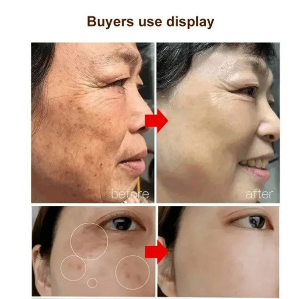 Hot sale Freckle removal and whitening cream